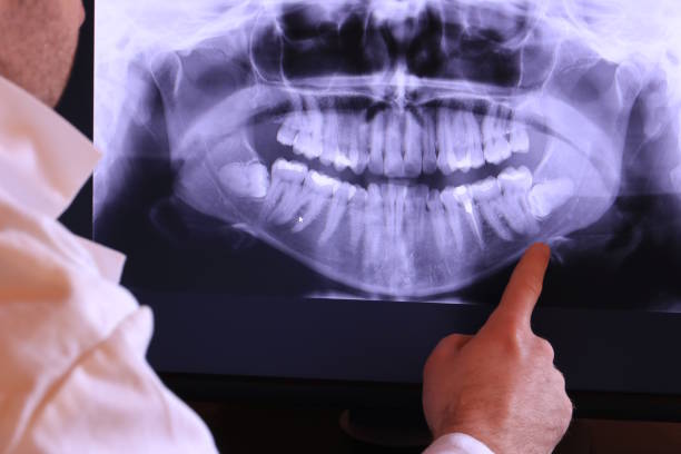 Best Broken or Cracked Tooth Emergency Dentist in Zebulon, GA